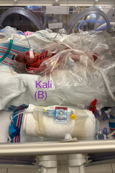 Kali at birth