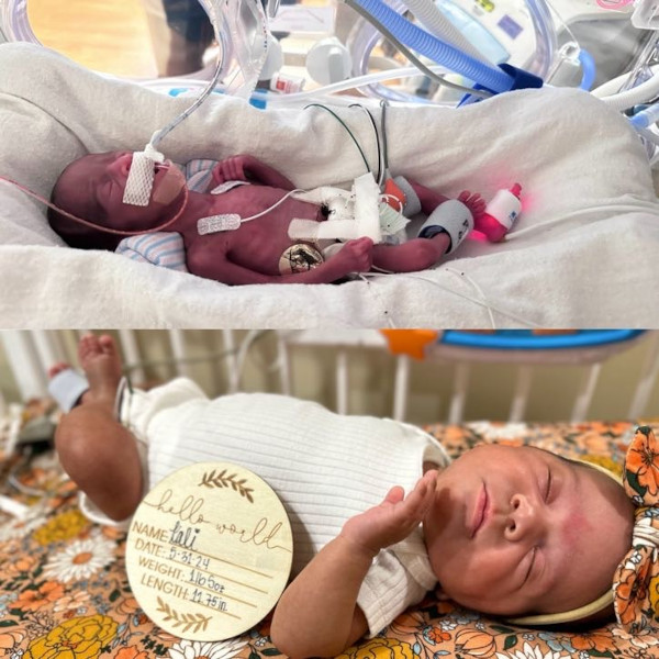 Kali birth vs. due date