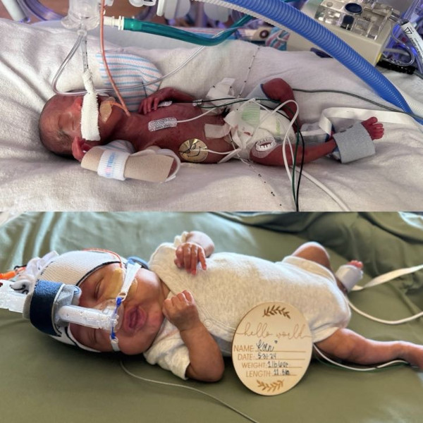 Koen birth vs. due date