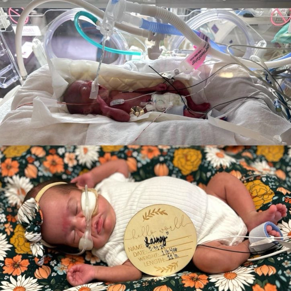 Lainey birth vs. due date