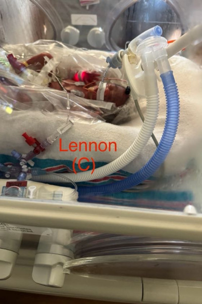 Lennon at birth