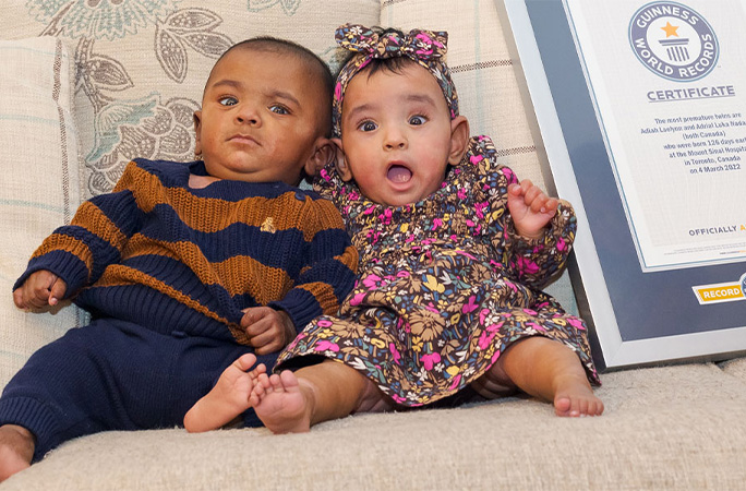 the prem twins as babies