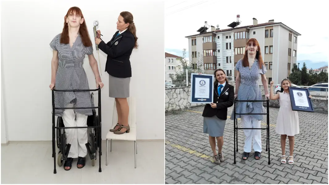 Turkey's Rumeysa Gelgi confirmed as tallest woman living