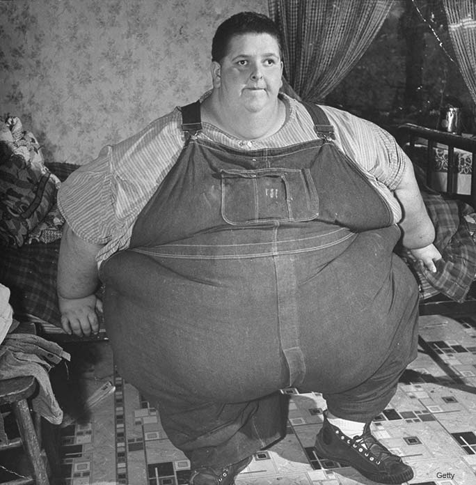 History Of Heaviest Humans As Worlds Biggest Man Loses Half His Body 