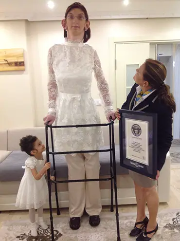 Turkeys Rumeysa Gelgi Is Awarded The Title Of Tallest Teenager Female In The World Guinness