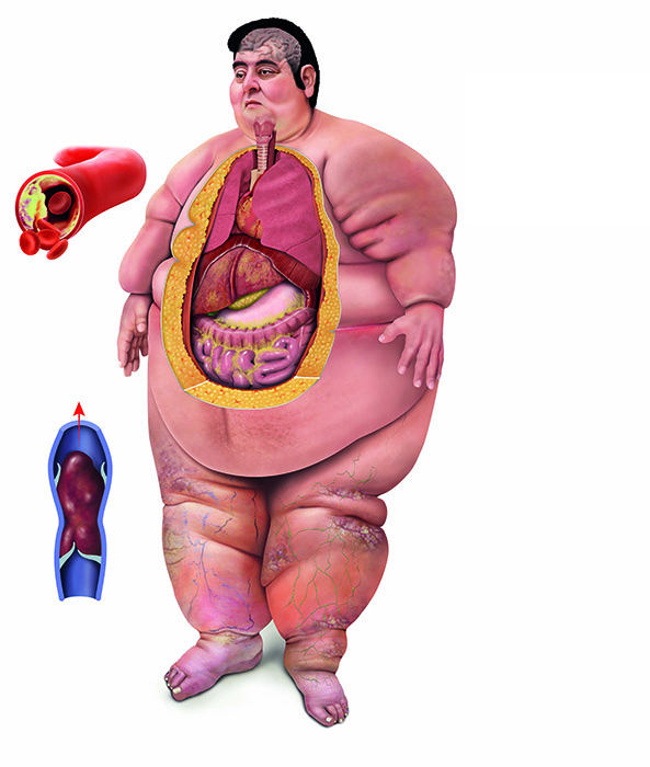 illustration of obese human white background