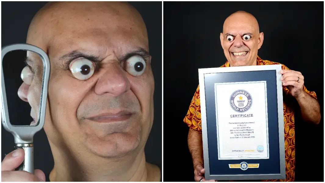 "My skill is a gift": Unbelievable eyeball pop world record