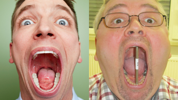 Header-widest-mouth-gape-collage-webstory-guinness-world-records