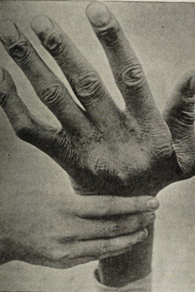 John Rogan's hand