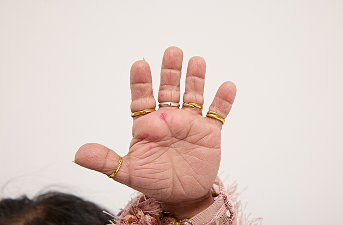 Jyoti holding up her hand