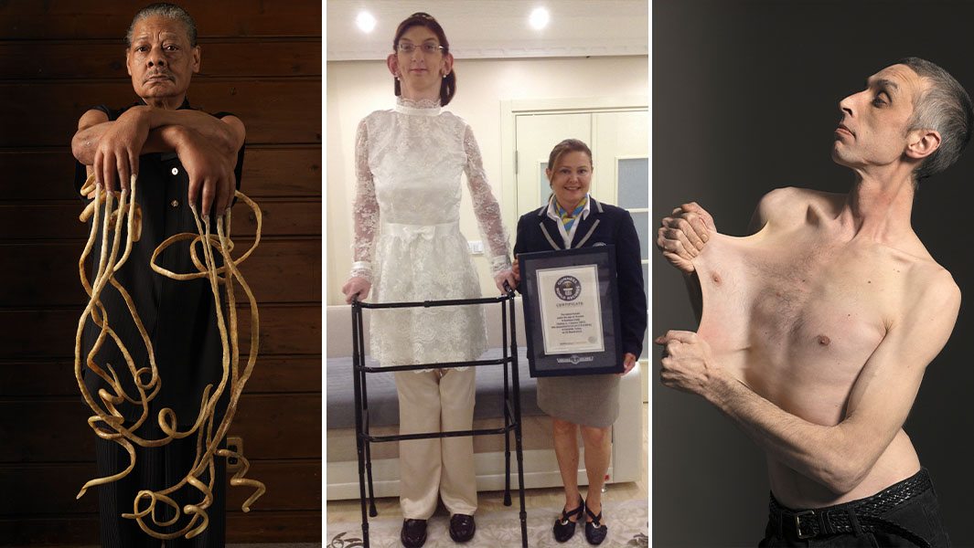 Split image of longest nails, tallest teenager and stretchiest skin