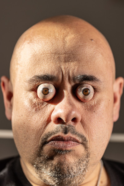 William's eyes from the front