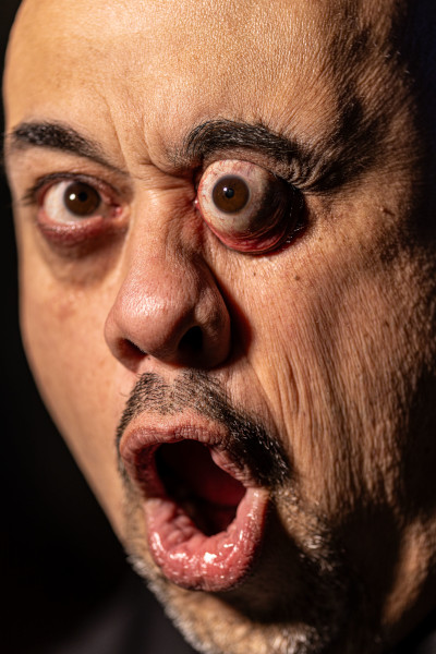 William with one eye popped