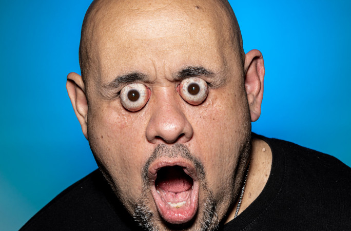 William with an open mouth