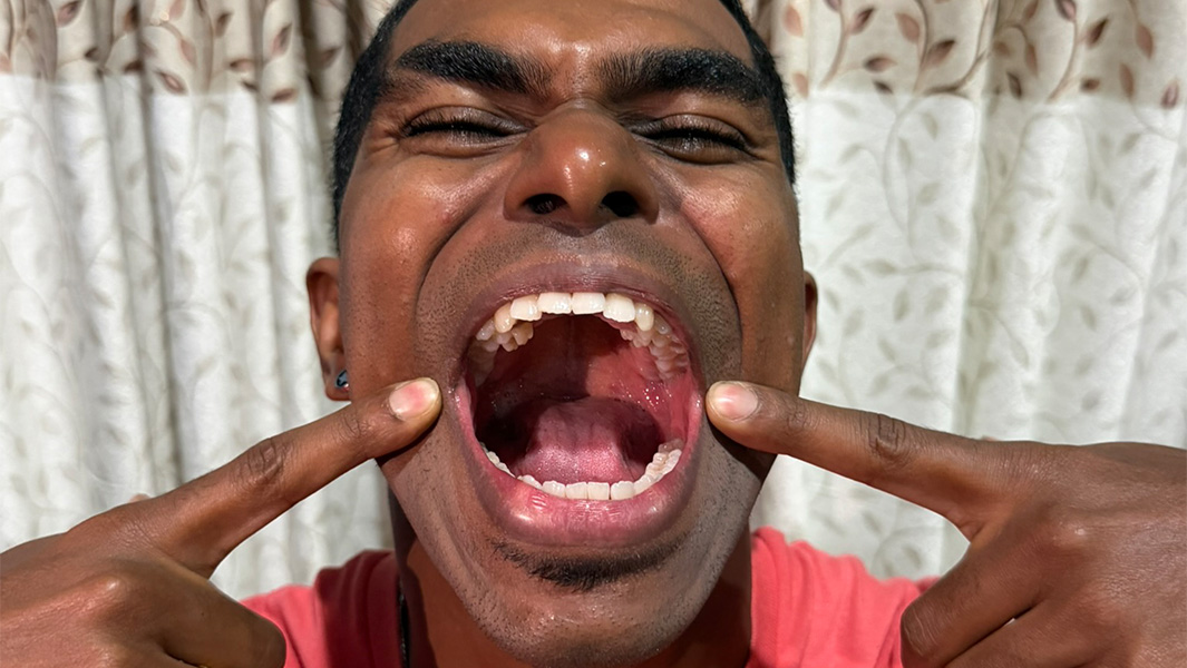 split image of Prathab smiling and with his mouth open
