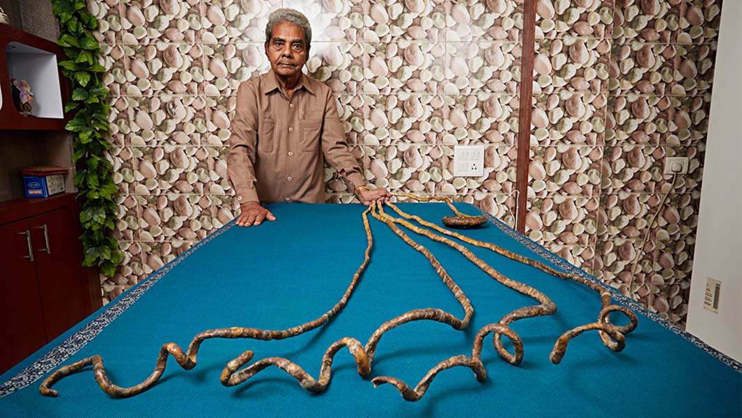 Shridhar Chillal with his nails lying across a table